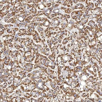 Thyroxine Binding Globulin Antibody / TBG / SERPINA7 - image 1