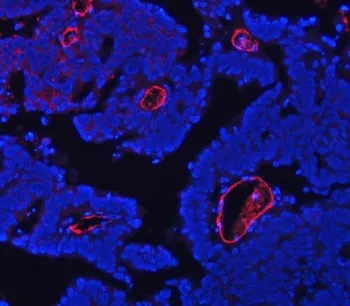 CD105 Antibody / Endoglin - image 1