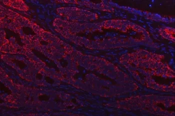 Thiosulfate sulfurtransferase Antibody / TST - image 1
