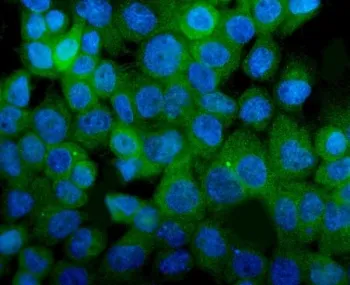 Integrin alpha 8 Antibody / ITGA8 - image 1