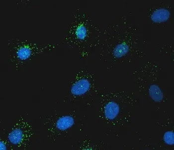Sorting nexin 1 Antibody / SNX1 - image 1