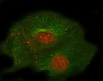 Thrombomodulin Antibody / THBD - image 1