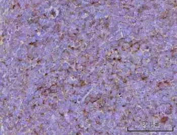 Cd39 Antibody / Entpd1 - image 1