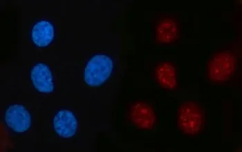 RFC2 Antibody / Replication factor C subunit 2 - image 1