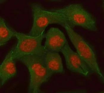 RFC3 Antibody / Replication factor C subunit 3 - image 1