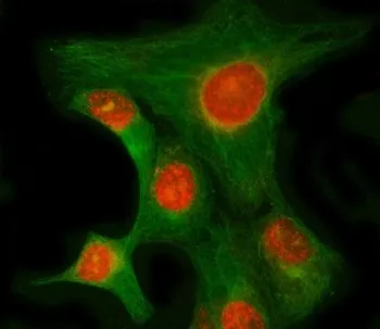 RIMKLB Antibody / Beta-citrylglutamate synthase B - image 1
