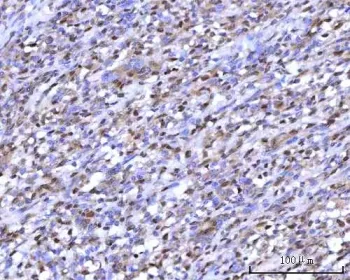 mRNA-capping enzyme Antibody / RNGTT / HCE - image 1