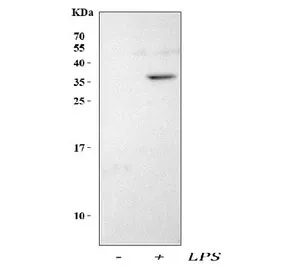 Interleukin-1 beta Antibody / IL-1 beta - image 1
