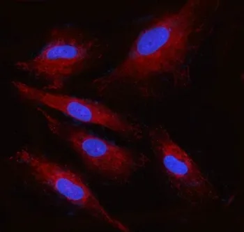 Ribophorin II Antibody / RPN2 - image 1