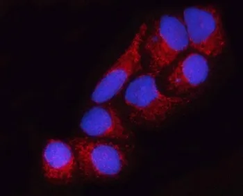 SUCLA2 Antibody / Succinyl-CoA synthetase beta-A chain - image 1