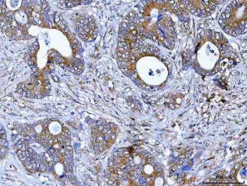PDXDC1 Antibody / Pyridoxal-dependent decarboxylase domain-containing protein 1 - image 1