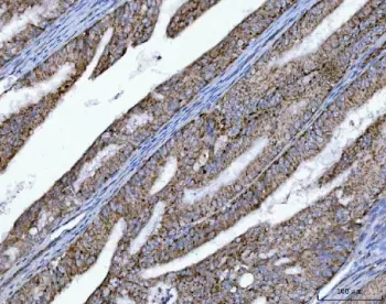 OXSM Antibody / 3 oxoacyl ACP synthase mitochondrial - image 1
