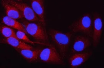 ORP8 Antibody / Oxysterol-binding protein-related protein 8 / OSBPL8 - image 1