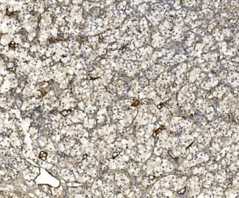 EIF3C Antibody / Eukaryotic translation initiation factor 3 subunit C - image 1