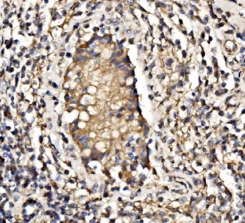 PI3-kinase subunit p85 alpha / PIK3R1 - image 1