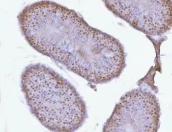 PRPF18 Antibody / Pre-mRNA-splicing factor 18 - image 1
