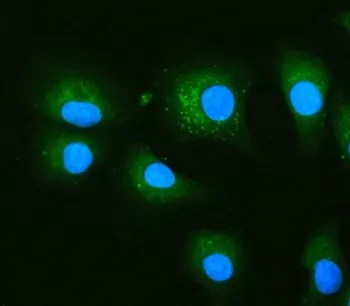 PRKCSH Antibody / Glucosidase 2 subunit beta - image 1
