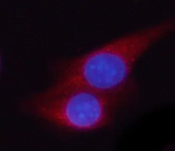 PGK2 Antibody / Phosphoglycerate kinase 2 - image 1