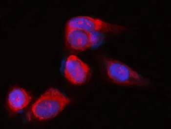 POLR1B Antibody / DNA-directed RNA polymerase I subunit RPA2 - image 1