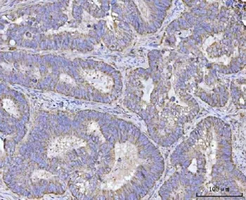 REN Antibody / Renin - image 1