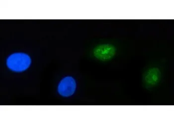 POLR3GL Antibody / RPC32 beta - image 1