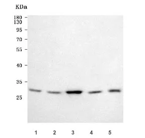 GCLM Antibody / Glutamate-Cysteine Ligase Regulatory Subunit - image 1