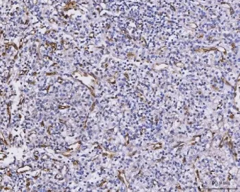 CXCL1 Antibody / GRO alpha - image 1