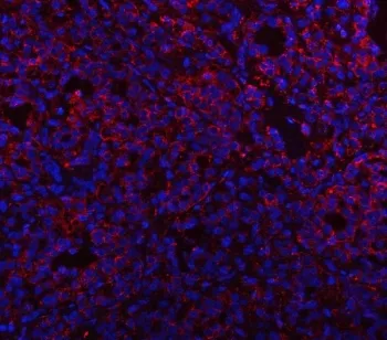 Prosaposin Antibody / PSAP - image 1