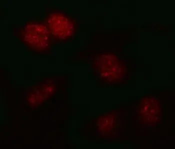 PSMB2 Antibody / Proteasome subunit beta type 2 - image 1