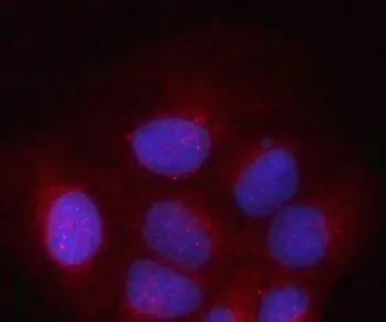 PSMD2 Antibody / 26S proteasome non-ATPase regulatory subunit 2 / TRAP2 - image 1