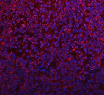 PYCR1 Antibody / Pyrroline-5-carboxylate reductase 1 - image 1
