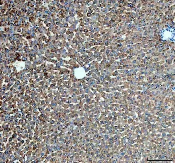 PYGL Antibody / Glycogen phosphorylase, Liver - image 1