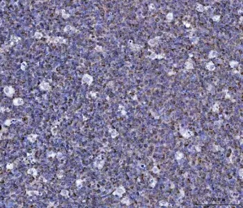 CCL15 Antibody / C-C motif chemokine 15 / MIP-5 - image 1