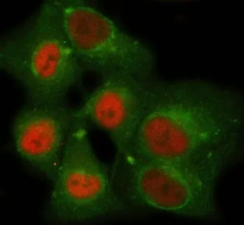 NEMF Antibody / SDCCAG1 - image 1