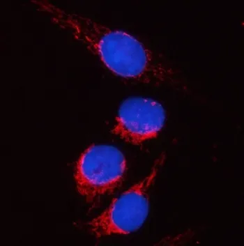 PYCR2 Antibody / Pyrroline-5-carboxylate reductase 2 - image 1