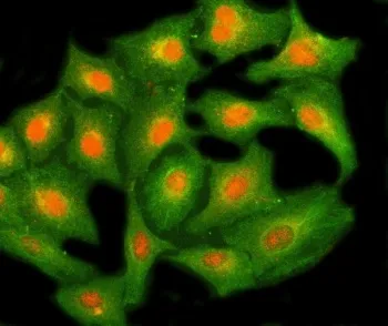 NHP2 Antibody / H/ACA ribonucleoprotein complex subunit 2 - image 1