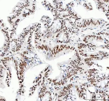 NUCKS1 Antibody / Nuclear ubiquitous casein and cyclin-dependent kinase substrate 1 - image 1