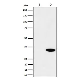Nucleophosmin Recombinant Antibody / NPM1 (pT199) - image 1