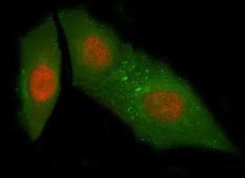 NUB1 Antibody / NEDD8 ultimate buster 1 / NYREN18 - image 1