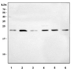 MSRB3 Antibody / Methionine-R-sulfoxide reductase B3 - image 1