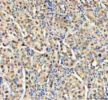 NUDT5 Antibody / ADP-sugar pyrophosphatase - image 1