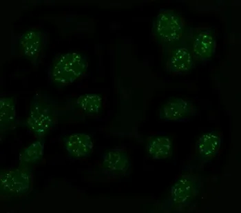MYT1L Antibody / Myelin transcription factor 1-like protein - image 1