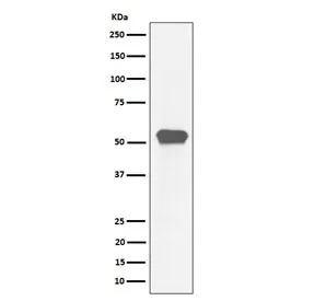 MEF2A Recombinant Antibody / Myocyte enhancer factor 2A - image 1
