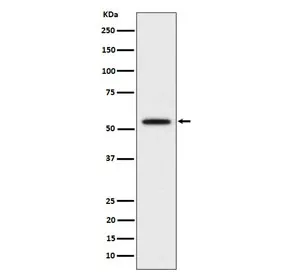 KATNA1 Recombinant Antibody / Katanin p60 ATPase containing subunit A1 - image 1