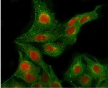 POLR2B Antibody / DNA-directed RNA polymerase II subunit RPB2 - image 1