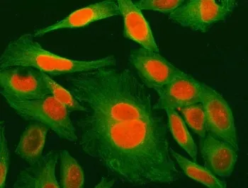 MED29 Antibody / Mediator of RNA polymerase II transcription subunit 29 - image 1