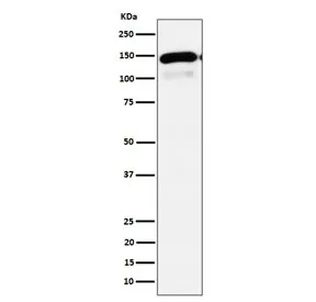 PLCB1 Recombinant Antibody / Phospholipase C-beta-1 - image 1