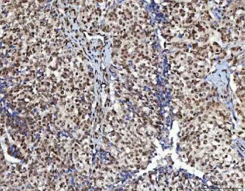 NUDCD1 Antibody / CML66 - image 1