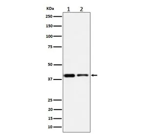 STOML2 Recombinant Antibody / Stomatin like 2 / SLP-2 - image 1