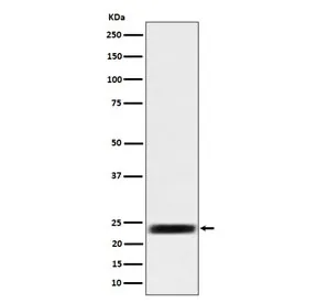 ARFRP1 Recombinant Antibody / ADP-ribosylation factor-related protein 1 - image 1